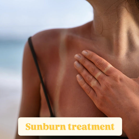 Sunburns and the UV's that cause your wrinkles