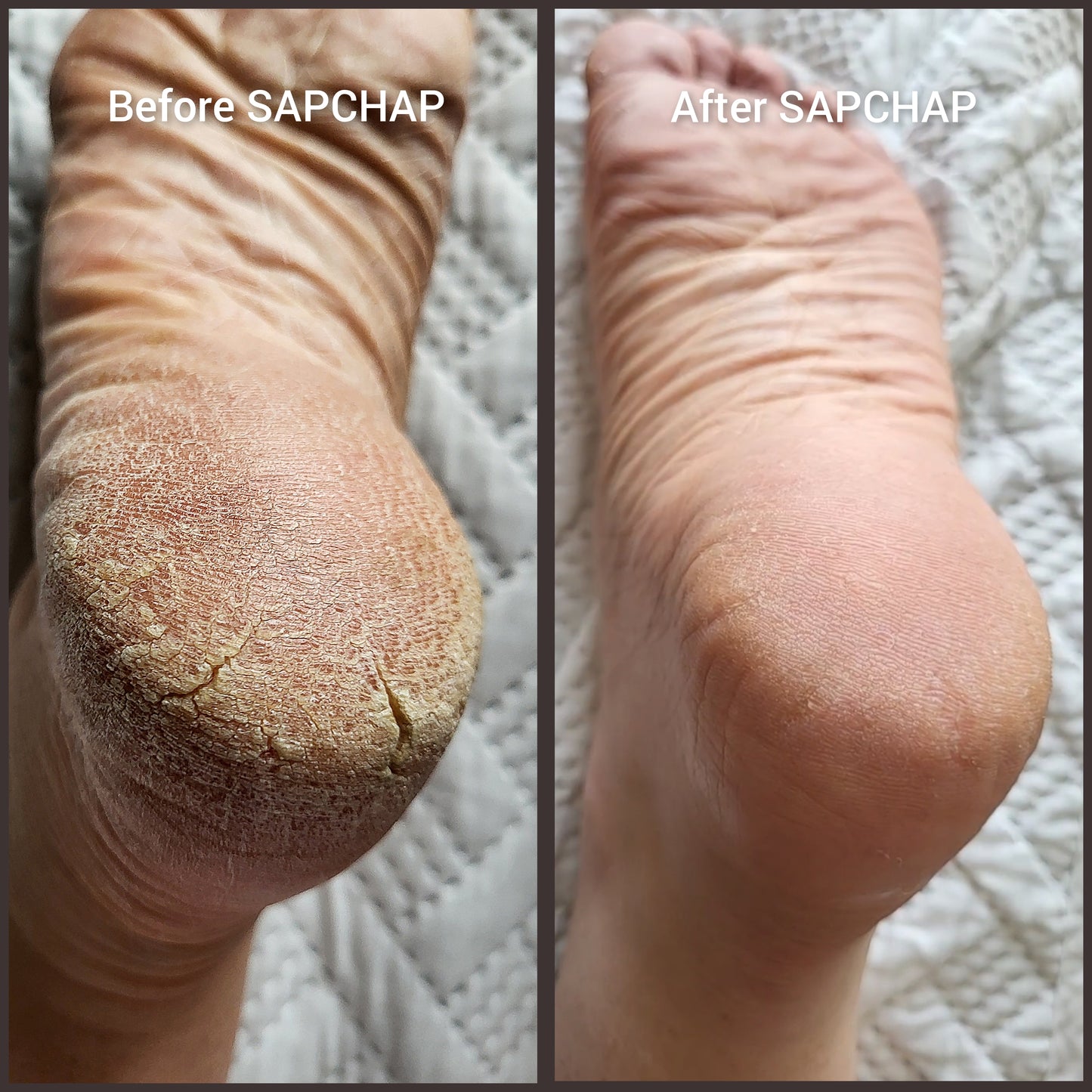SAP CHAP Skincare Cream